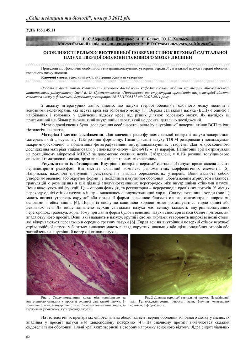 ОСОБЛИВОСТІ РЕЛЬЄФУ ВНУТРІШНЬОЇ ПОВЕРХНІ СТІНОК ВЕРХНЬОЇ САГІТАЛЬНОЇ ПАЗУХИ ТВЕРДОЇ ОБОЛОНИ ГОЛОВНОГ