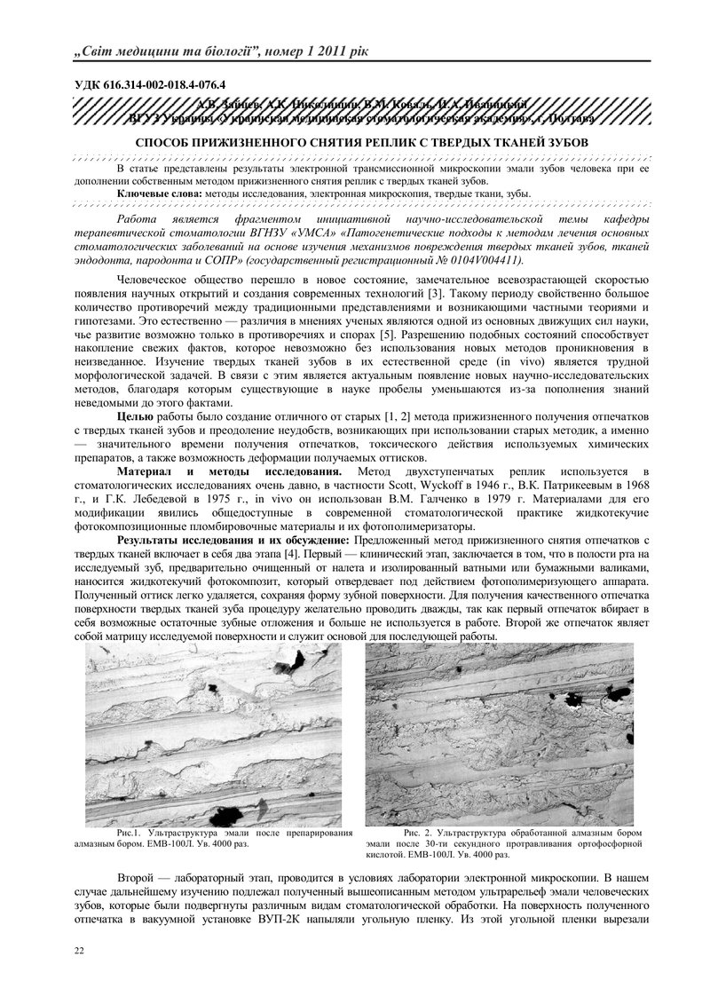 СПОСІБ ПРИЖИТТЄВОГО ЗНЯТТЯ РЕПЛІК З ТВЕРДИХ ТКАНИН ЗУБІВ